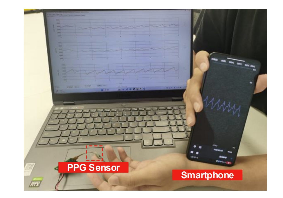 AcousAF: Acoustic Sensing-Based Atrial Fibrillation Detection System for Mobile Phones