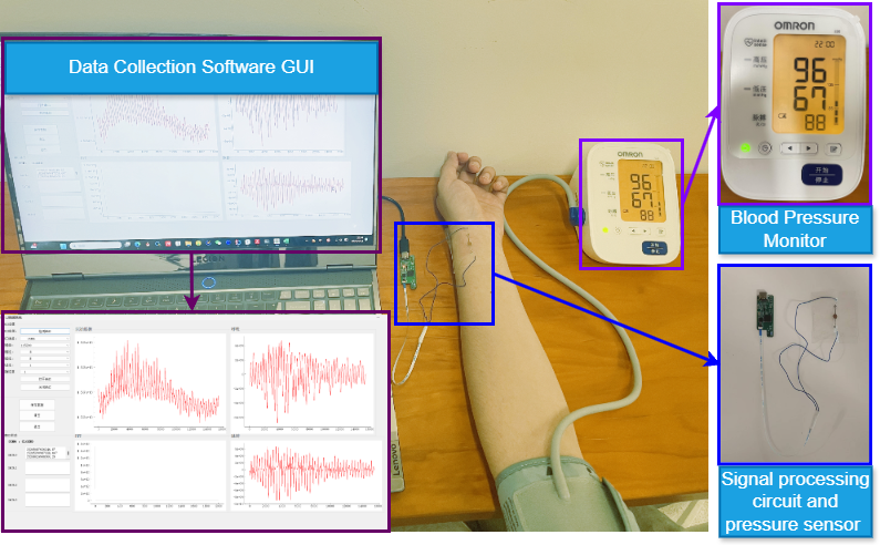 FlexibleBP: Blood Pressure Monitoring Using Wrist-worn Flexible Sensor